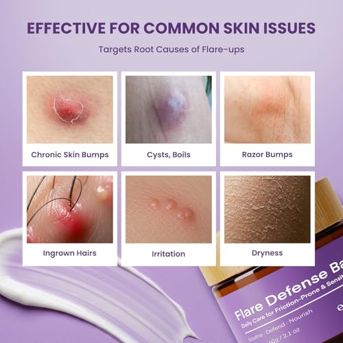 Hidradenitis Suppurativa Flare Defense Balm: Advanced Scienced-Backed Salve for HS, Boils, Cysts & Folliculitis ? with Microsilver BG¢â, Zinc Oxide & Botanical Blend (2 Ounce (Pack of 2))