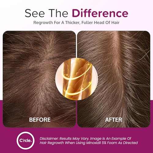 C'rcle 5% Minoxidil Foam for Women, Unscented, 2-Pack (4.2 fl oz each) 8-Month Supply