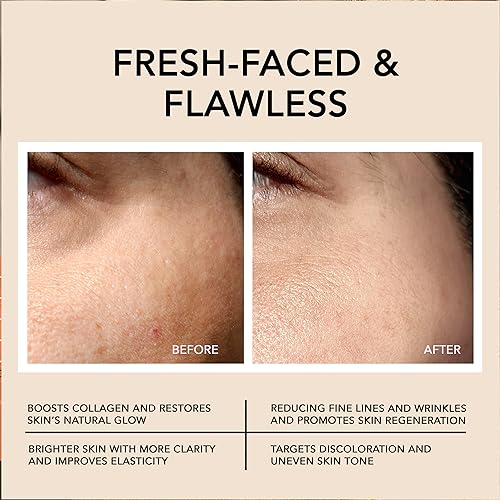 Go Beauty Daily Skin Brightening & Tightening Serum with Vitamin C, Niacinamide, Vitamin B5, Collagen & + 7 Peptide Complex for Dark Spots, Dull & Uneven Skin Tone ? Glowing Essence,1 fl. Oz