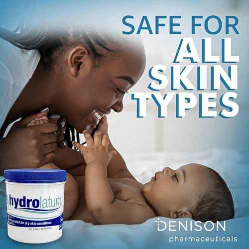 Moisturizing Cream Tub: Hydrating, Lightweight Non-Greasy Moisturizer for Women & Men, Nourishing Lotion for Sensitive Skin, Face & Body Cream for Soft, Smooth ? 12oz