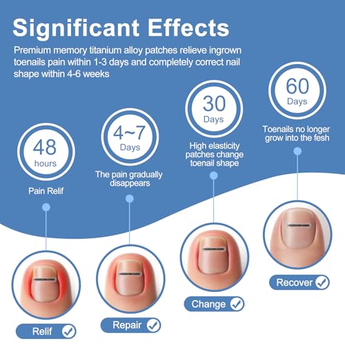 12Pcs Ingrown Toenail Corrector Strips for Curved Toenail Quick Relief,4 Multi-Sizes Ingrown Toenail Treatment Relief Tools Kit for Home Use