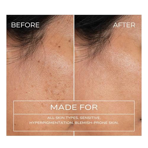 Fitglow Beauty Clear + Bright Mandelic Serum Drops | Gentle Exfoliating Face Serum | Evens Tone, Corrects Discoloration & Clears Breakouts | Hyaluronic Acid | 30ml