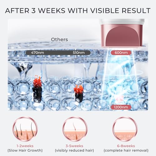 IPL Laser Hair Removal Device for Whole Body, Painless & Long-Lasting Results