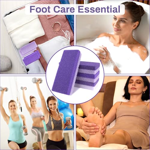 RAQEHO 10-Pack Dual-Sided Foot Pumice Stone for Callus & Hard Skin