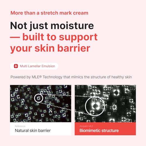 ATOPALM Maternity Stretch Mark Cream 150ml | Pregnancy Skin Care