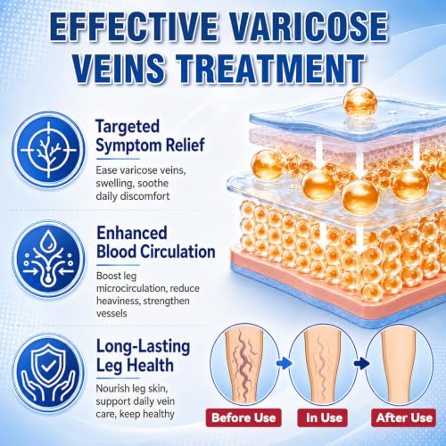 Bellemora Varicose Veins Cream – Relief for Legs & Circulation