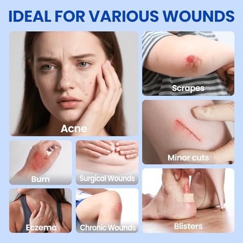 Hydrocolloid Roll Bandages - Medical Grade Skin Protection (2in x 5ft)