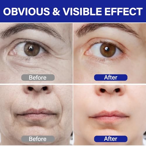 PDRN Serum?Lifts and firms, Reduces Wrinkles, Deeply Moisturizes?Peptides, PDRN?Anti-aging, Improves Dullness