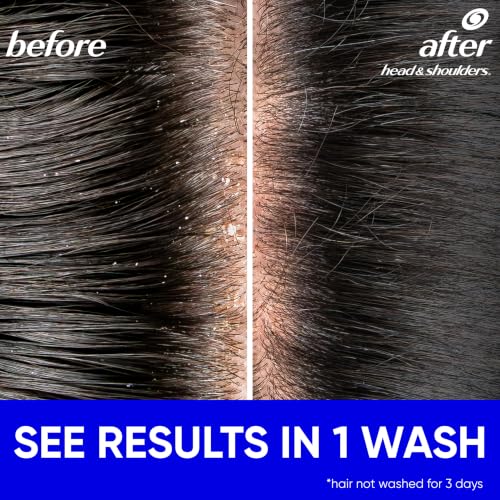 Head & Shoulders Classic Clean Anti-Dandruff Shampoo 28.2 fl oz - Pack of 1