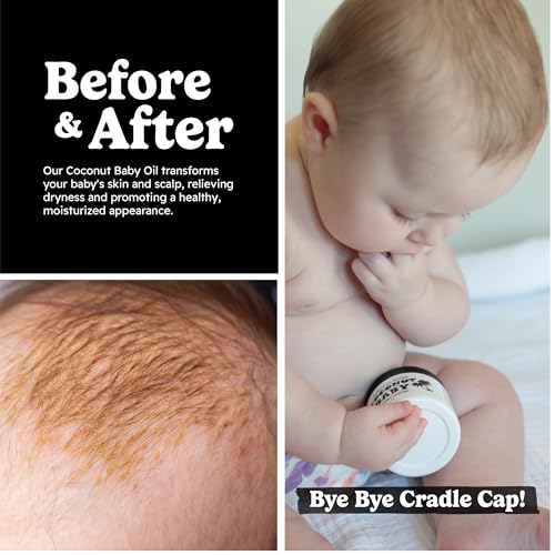 Organic Coconut Baby Oil for Cradle Cap & Sensitive Skin - 2 fl oz