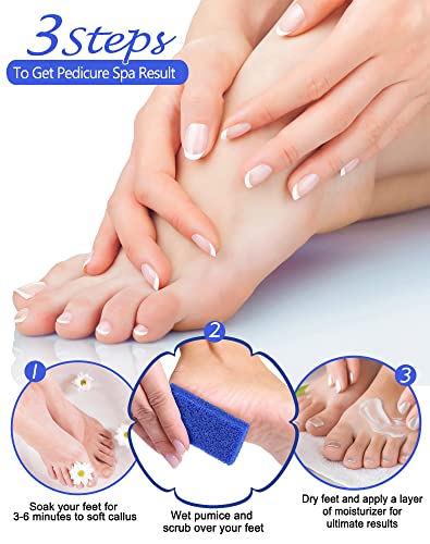 Maryton Disposable Pedicure Pumice Stones - Coarse Grit Callus Remover (40 Pack)