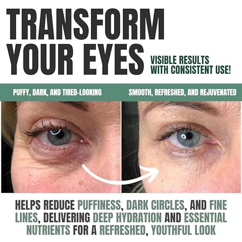 Alozera Wake Up Under Eye Gel Cream | Anti-Aging Cooling Treatment