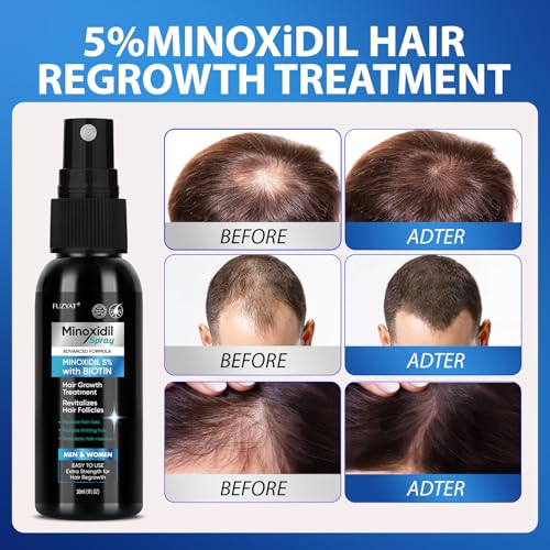 5% Minoxidil Hair Growth Spray for Men & Women 60ml