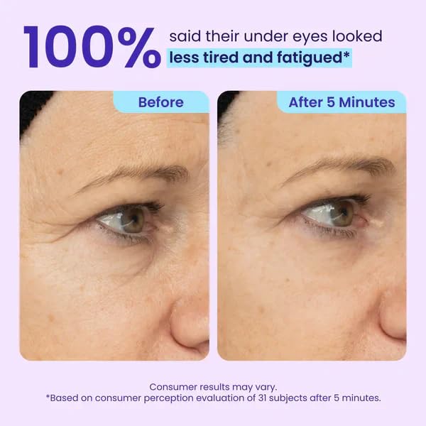Eye Lift Gel - Firm Depuff Bags & Wrinkles | Microalgae