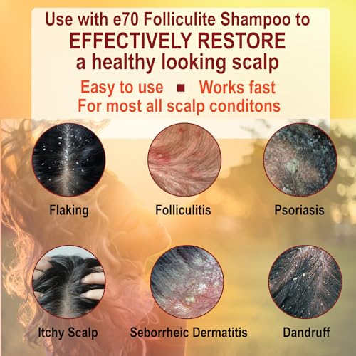 Folliculitis Treatment Conditioner with Salicylic Acid & Tea Tree Oil - Anti-Itch Scalp Care, 8 Fl Oz