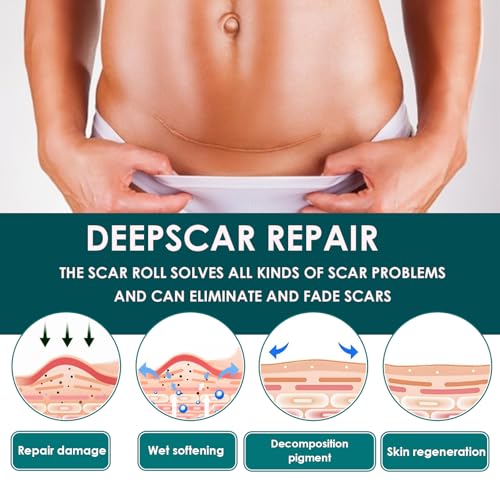 Silicone Scar Tape, Premium Silicone Gel Scar Sheets (1.6"x 60" Roll-1.5M), Reusable Silicone Patches, Soft Silicone Tape for Surgeries Scars, C-Sections, Wrinkles et