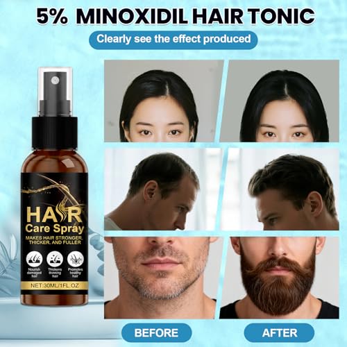 Minoxidil Hair Growth Spray for Men & Women - 3 Pack, 5% Solution for Thinning Hair