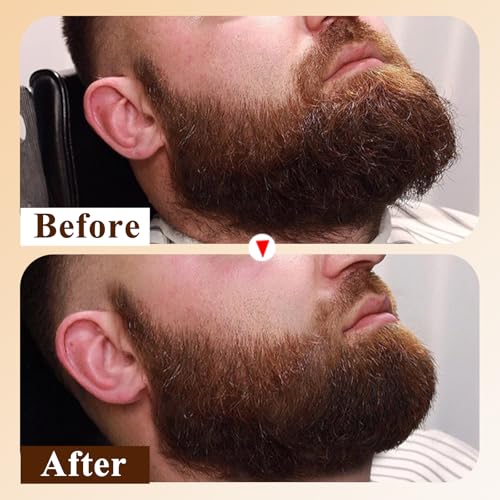 Beard Oil for Men,Natural Mens Beard Oil Capsules,Naturally Derived Conditioner with Argan Oil,Grapeseed Oil,Jojoba Oil and Vitamin E for Softening and Moisturizing Beard(Cedarwood)
