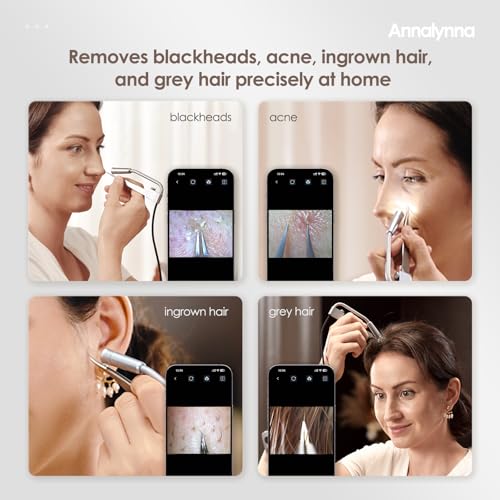 Luma 1 Visual Blackhead Remover Tweezers with Camera - Pimple Popper Tool with Camera 20x Magnification, 1080P, 8 LED Lights, with Blackhead Remover Pimple Popper Tool Kit (6 Piece Kit),Gray Blue