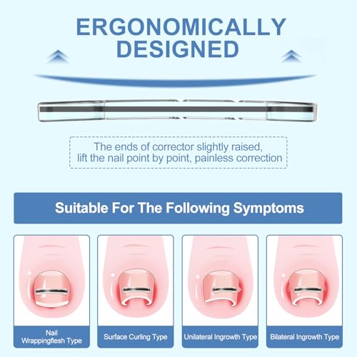 12Pcs Ingrown Toenail Corrector Strips for Curved Toenail Quick Relief,4 Multi-Sizes Ingrown Toenail Treatment Relief Tools Kit for Home Use