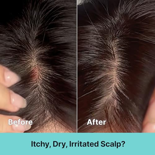 Kelp Scalp Treatment Spray for Itchy Sensitive Scalp 80ml