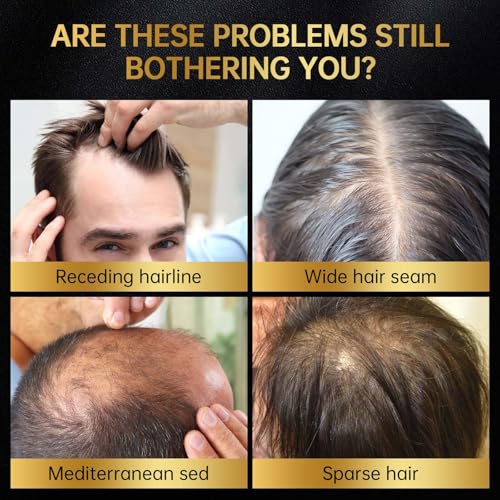 Minoxidil 5% Hair Regrowth Serum for Men & Women, 60ml