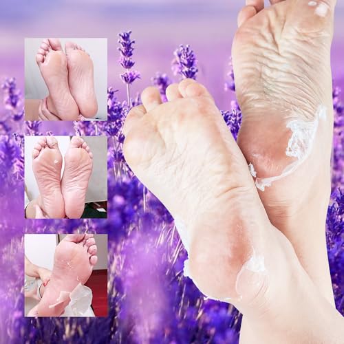 Foot Peeling Mask - 5 Pack Exfoliating Socks for Dry Cracked Feet