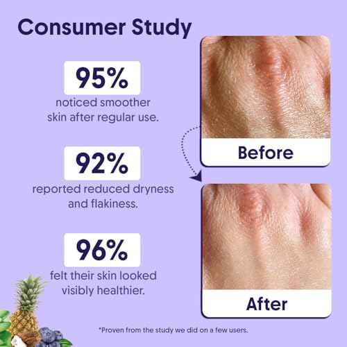 Aravi Organic 10% AHA + 1% BHA Exfoliating Body Lotion - Glycolic & Lactic Acid Body Lotion with Niacinamide - Smooths Rough & Bumpy Skin with Anti-Aging - 6.76 Fl Oz / 200ml