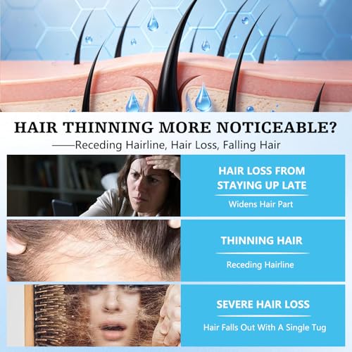 5% Minoxidil Hair Growth Shampoo for Men & Women