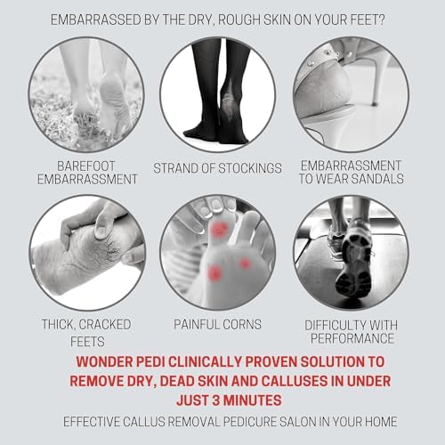 Instant Feet Callus Remover Spray - Quick Peeling Formula, 100ml