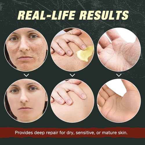 Tallow Balm With Castor Oil and Frankincense Skin Balm, Beef Tallow Moisturizer, Frankincense Oil for Skin, 100% Grass-Fed, Nourish & Repairing Dry Skin, Face & Body Cream