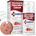 Folliculitis Cream with 5% Benzoyl Peroxide for Bump Relief - 3.53 Fl Oz