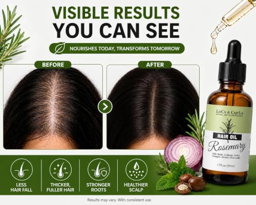 Rosemary Hair Oil for Hair Growth – Scalp Treatment with Castor, Biotin & Keratin, Nourishing Oil for Thicker-Looking Hair