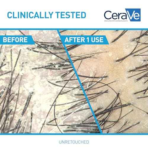 CeraVe Hydrating Anti Dandruff Conditioner, 0.5% Pyrithione Zinc Dandruff Treatment With Ceramides, Hyaluronic Acid & Niacinamide, Helps Eliminate Flakes & Reduce Itchy Scalp, Sulfate Free Conditioner