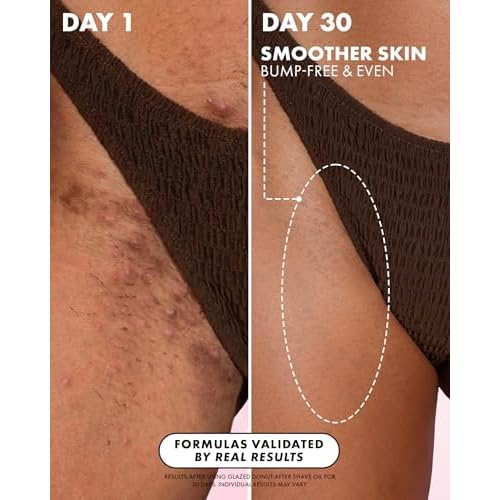Truly Luxury After Shave Oil | Soothing & Hydrating Treatment to Prevent Ingrown Hair For Smooth, Irritation-Free Skin for Daily Use