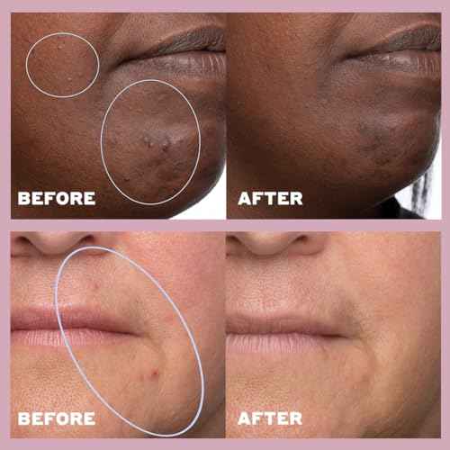 Volition Beauty Skin Rhythm Balancing & Cleaning Serum with Niacinamide + Salicylic Acid | Acne & Blemish Treatment | Helps Even Skin Tone, Fade Dark Spots, Reduce Acne Scars