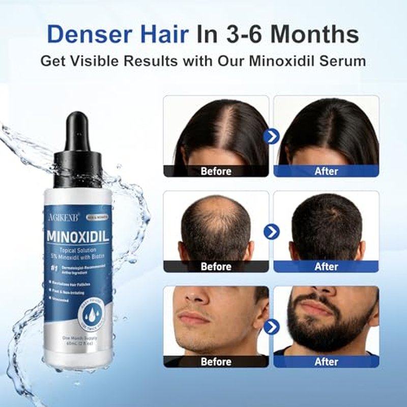 5% Minoxidil Hair Regrowth Serum for Men & Women, 8-Pack