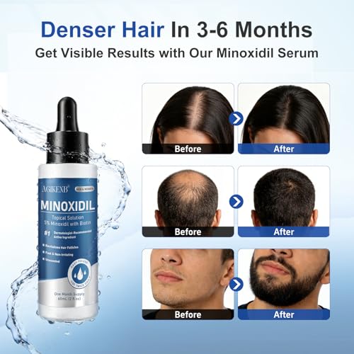 Minoxidil Hair Regrowth Serum 8-Pack for Men & Women - Thicker Hair & Beard Support