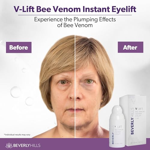 Beverly Hills V-Lift Bee Venom Eye Serum - Reduce Puffy Eyes & Dark Circles