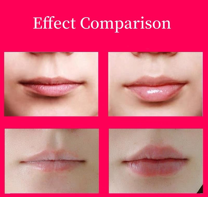 Electric Lip Plumper - Lip Suction Enhancer Tool 450mah