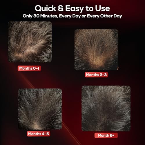 Laser Hair Growth Cap - LLLT Device for Men & Women
