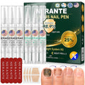 Nerante Toenail Fungus Treatment Pen Set - 6 Pens with 25% Undecylenic Acid