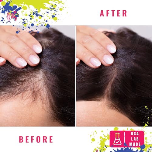 Advanced Hair Growth Serum with 4.65% 2DDR - All-Natural Formula for Men & Women