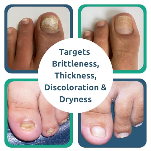 Dr. Blaine's Tineacide Nail Renewal Gel 1.25 oz with Precision Clippers