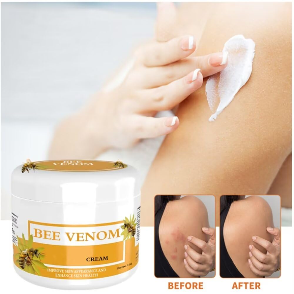 YunNing Bee Venom Cream, Honey Cream for Neck, Waist, Back of Hands, Feet and Legs 2Pcs - HS01