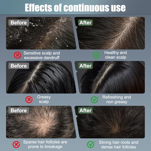 Laser Hair Growth Comb with Red Light Therapy