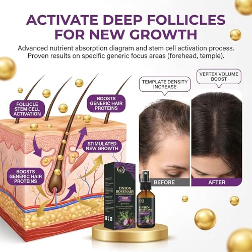 Onion Oil Hair Growth Serum with Rosemary & Black Rice