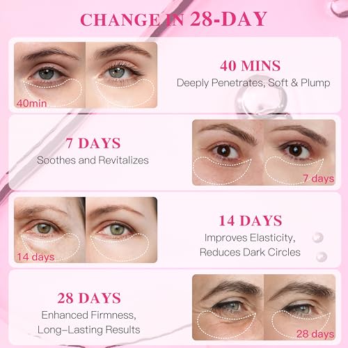 Under Eye Patches with Collagen, Eye Patches for Puffy Eyes and Dark Circles, Glowing - Deep Hydrating Hydrogel Eye Mask for Wrinkles, Fine Lines, Gifts for Women - Skin Care, 30 Pairs (White)