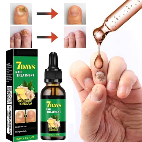 IMOLL Ginger Nail Growth Serum & Cuticle Oil - Nail Care Treatment (2 Pack)