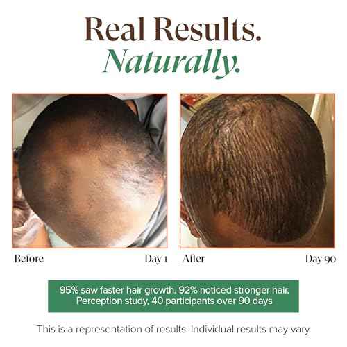 Kreyol Essence - Haitian Black Castor Oil for Skin and Hair, Glass Bottle | Cold Pressed | Hexane Free | Fuller-Looking Hair